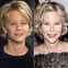 Botox-Panne: Meg Ryan ist kaum wiederzuerkennen! - Die Schauspielerin hat der Beauty-Wahn gepackt