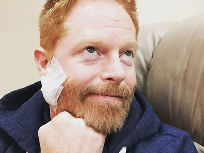 Jesse Tyler Ferguson: Schockdiagnose für „Modern Family"-Star - Der Serien-Schauspieler leidet an Hautkrebs