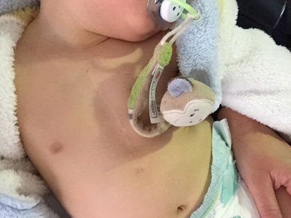 Sarah Lombardi zeigt erstmals OP-Narbe von Baby Alessio - Die junge Mutter blickt zuversichtlich in die Zukunft ihres Sohnes