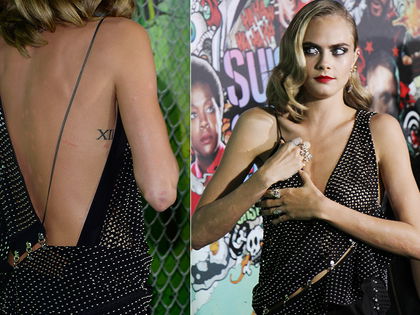 Cara Delevingne & Co.: Hilfe, wie seht ihr denn aus? - Ausschlag, Pickel, Herpes: Wenn die Seele leidet, schlägt die Haut Alarm