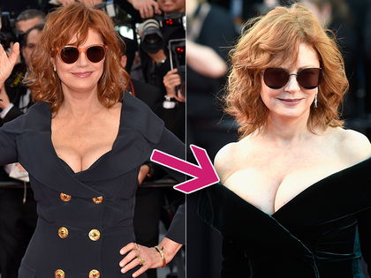 Susan Sarandon: Busen-Vergrößerung mit 70? - Ärzte sicher: Die Schauspielerin ließ aus einem Körbchen C ein Doppel-D operieren!
