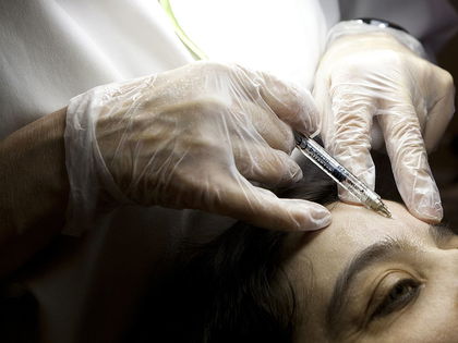 Beton statt Botox: Schwarzmarkt-OP und ein Filler-Cocktail aus Zement zerstörten ihr Gesicht  - Sie geriet in die Hände eines Pfuschers 