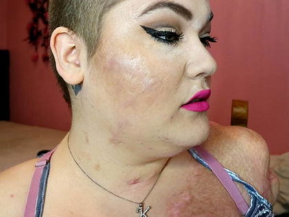 Ohne Arme & Beine: Beauty-Bloggerin erobert das Netz! - Das Schicksal von Kaitlyn Dobrow ist bewegend und inspirierend zugleich