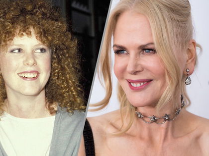Die geheime OP-Akte von Nicole Kidman: Ihre 1-Millionen-Dollar-Verwandlung - Zahnfleisch-OP, Gesichtslifting, Busen-Operation und Co. - DAS ließ die Schauspielerin alles machen