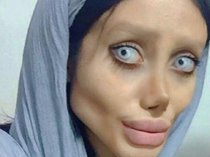 Sahar Tabar: Grusel-Schock! Über 50 Operationen um wie Angelina Jolie auszusehen - Doch dass die Iranerin sich SO verändert, hätten wir nicht gedacht