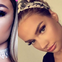 Shirin David: OMG – Die merkwürdige Metamorphose ihrer Lippe! - Viel hilft eben nicht immer viel...