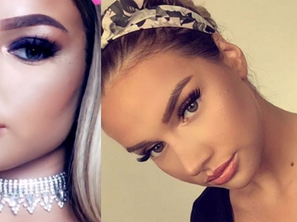 Shirin David: OMG – Die merkwürdige Metamorphose ihrer Lippe! - Viel hilft eben nicht immer viel...