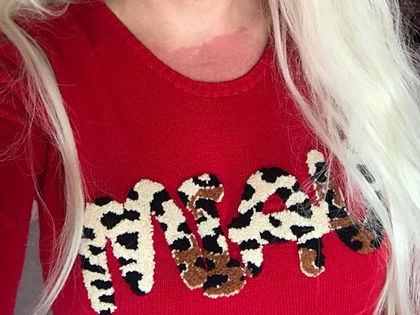 Autsch! Daniela Katzenberger: Bräunungs-Desaster - "Die gleiche Farbe wie mein Pulli": Die 31-Jährige verbrennt sich im Solarium