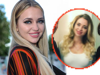 Cathy Lugner: Nasen-OP-Fail! - Ups … Dieser Eingriff ging mächtig in die Hose