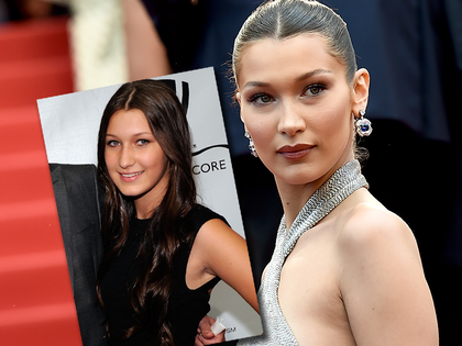 Ernsthaft? Bella Hadid streitet Beauty-OP ab! - Die Fans des Models sind entsetzt: „Keine gute Idee zu lügen“