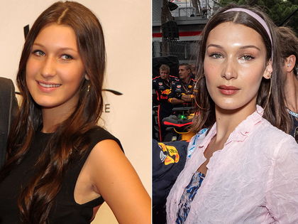 Bella Hadid & Co.: Hört doch auf zu lügen! - Diese Promi-Ladys hatten angeblich keine Beauty-Operationen
