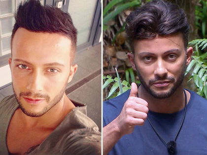 Ohne Toupet: So sah Domenico de Cicco früher aus! - "Es hat sich für mich einfach zu diesem Zeitpunkt gut angefühlt"