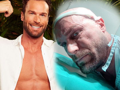Bastian Yotta: Gefährliche Haartransplantation - OKmag.de-Experte: "Es besteht das Risiko, dass sich Narben bilden"
