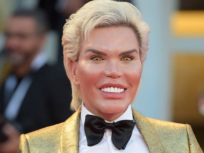 OP-Wahnsinn von Rodrigo Alves: Fällt der Real-Life-Ken bald auseinander? - Der Plastik-Liebhaber hätte schon fast seine Nase verloren