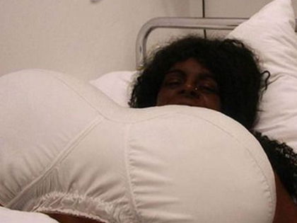 Busenwunder Martina Big: Sorge wegen neuer Riesen-Brüste