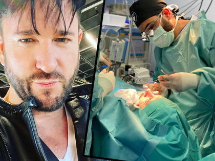 Michael Wendler: Krasse Bilder seiner Nasen-OP! - Der Musiker ließ sich von Kameras zum Beauty-Doc begleiten