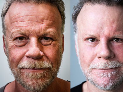Jenke "Schönheits-Experiment": Die bittere Wahrheit - "Die meistens Veränderungen werden nicht von Dauer sein"