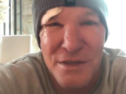 "Goodbye Deutschland"-Steff Jerkel nach OP: "Josephine hat sich erschrocken" - Der TV-Auswanderer gibt ein Update bei Instagram