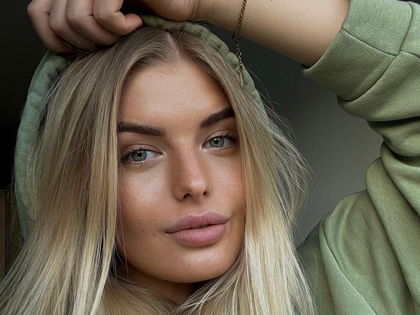 "Bauer sucht Frau"-Antonia Hemmer: Endlich Klartext! Beauty-OP-Beichte - "Bin eine der wenigen, die dazu steht"