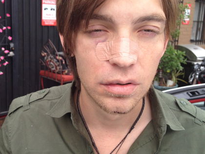 The Calling Alex Band entführt - ungeborenes Kind als Retter - Verschleppt, verprügelt, ausgeraubt und 'dem Tod überlassen'