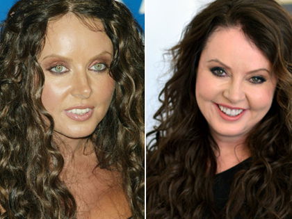 Sängerin Sarah Brightman erschreckt mit Gesichts-Beauty-OPs - Nun erinnert sie an ein Nagetier