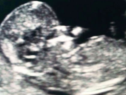 Ultraschallbild! Wird Elyas M'Barek etwa Papa? - Der Schauspieler verwirrt mit einem Foto seine Fans