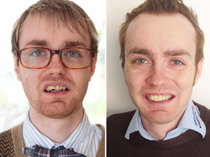 'Beauty and the Nerd'-Sieger Kevin lässt sich Zahn richten! - Seinen Gewinn will der 28-Jährige spenden