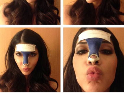 Micaela Schäfer - Shitstorm nach Nasen-OP - Facebook-User sind nicht amüsiert über das Gips-Foto